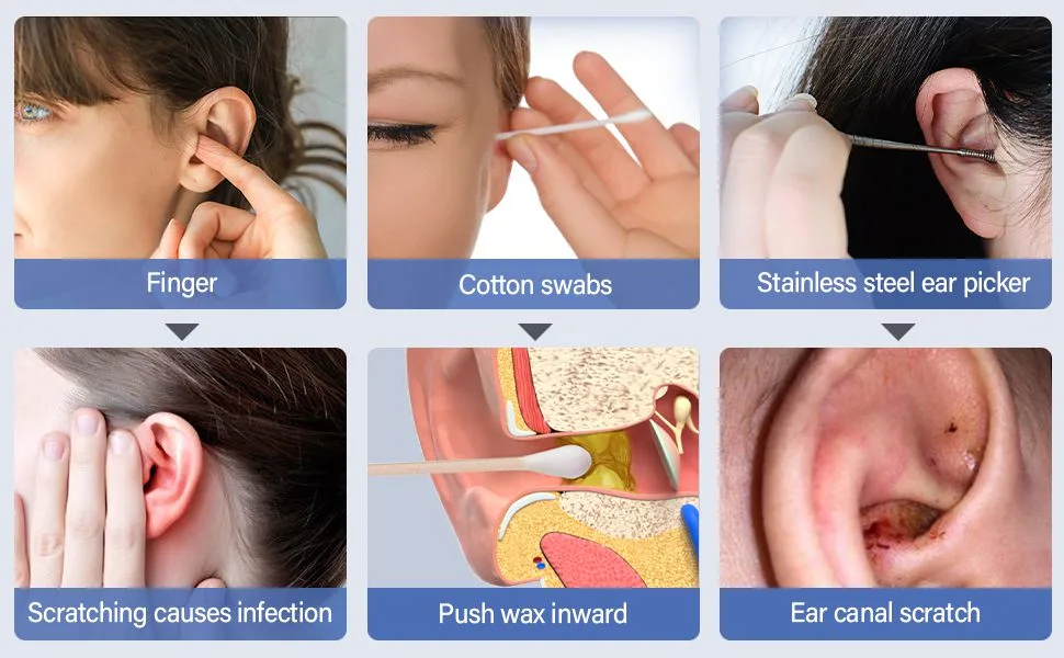 Electric Ear Suction Device Portable Automatic Electric Vacuum Ear Pick Ear Cleaner Earwax Remover with LED Light for Earwax Removal Soft Prevent Ear Pick Clean Tools Set (Black) - product information 5