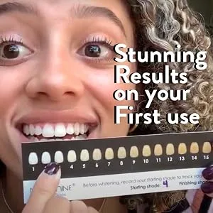 Novashine Professional Teeth Whitening Kit Couples Bundle Advanced LED Light Fast Results Bundle for Two - Teeth Whitening Kit Inside Photos