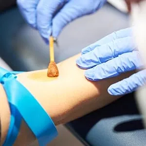 McKesson PVP Prep Solution USP 10% Povidone-Iodine 1 gal 1 Count 153.72 Fl Oz (Pack of 1) - Nurse applying McKesson PVP Prep Solution before collecting blood sample