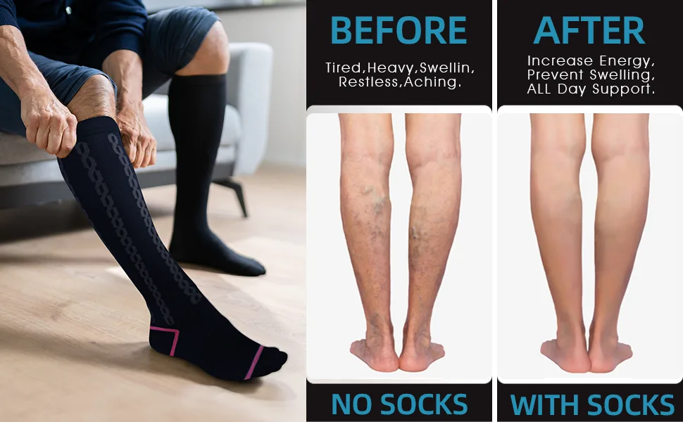 Medical Graduated Compression Socks for Men & Women 30-40 mmHg-2 Pack Extra Firm Support Knee High Circulation Socks Large-X-Large 01 Black black-cable Pattern - compression socks
