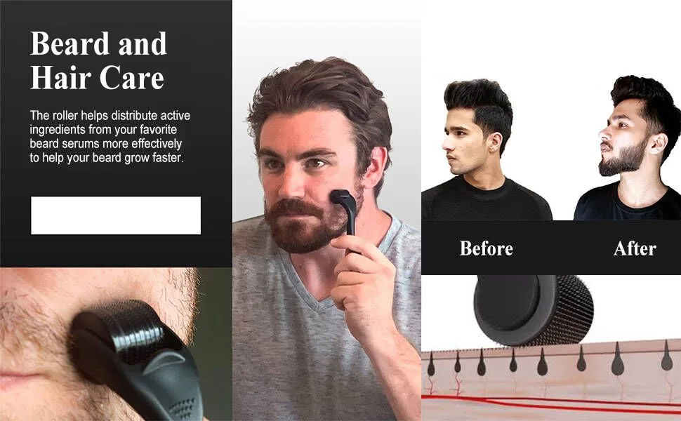 Derma Roller Beard Roller for Face Home Use 540 Titanium Micro Needle Roller for Skin Care Beard Growth Travel Case Included Black0.5 - product information 2