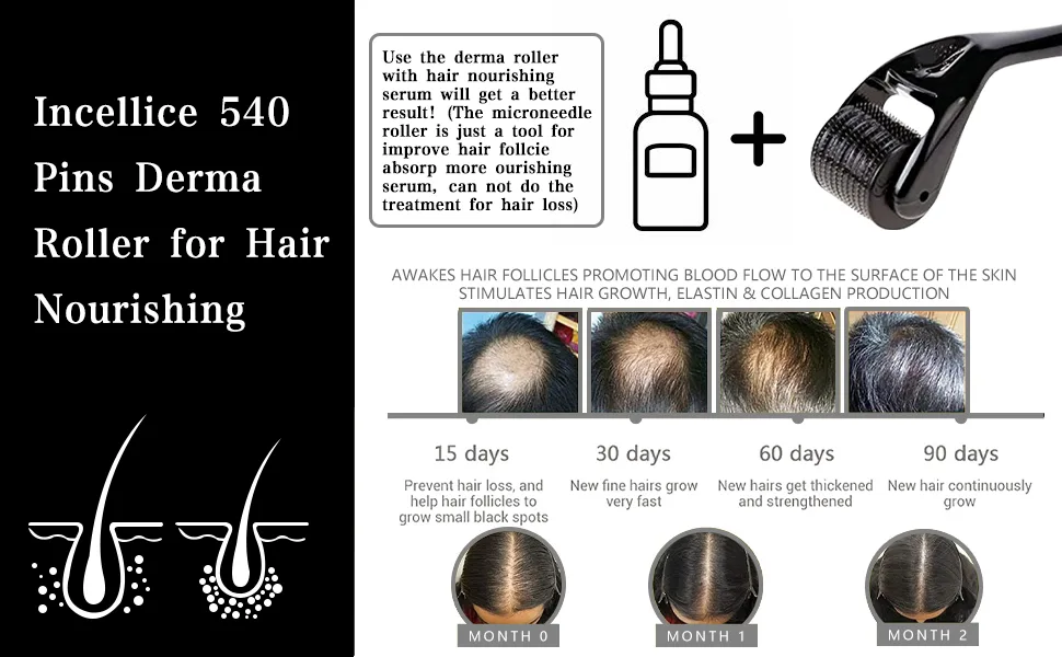 Derma Roller Beard Roller for Face Home Use 540 Titanium Micro Needle Roller for Skin Care Beard Growth Travel Case Included Black0.5 - product information 3