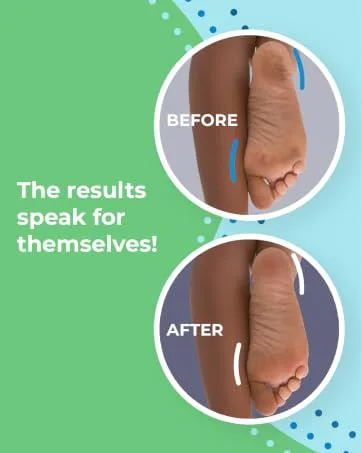 4 x Super Coarse Micro Mineral Replacement Rollers Compatible with Emjoi Micro Pedi - spa results pedicure