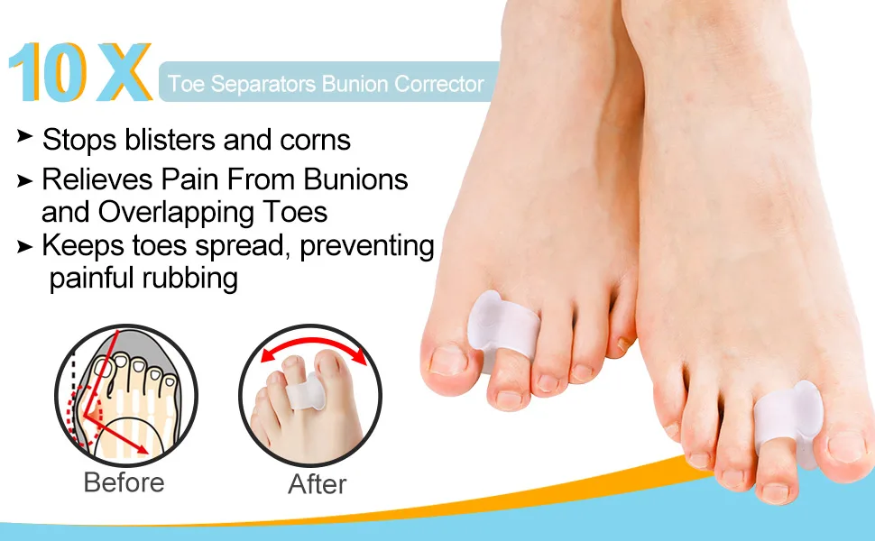 Sumiwish Bunion Corrector Toe Spacer Gel Toe Separators Overlapping Toe Correction with Loop Toe Straightener Great for Bunion Pain Relief (5 Pairs/10 PCS) Clear - Toe separators