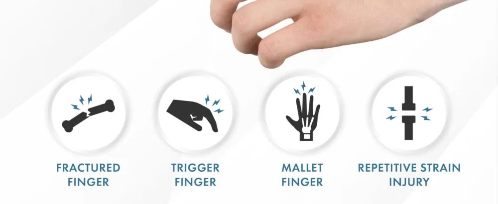 Actesso Neoprene Finger Splint Brace Injury Support for Mallet Finger Trigger Finger Finger Pain & Broken Finger for Index Middle & Ring (Beige) - Conditions