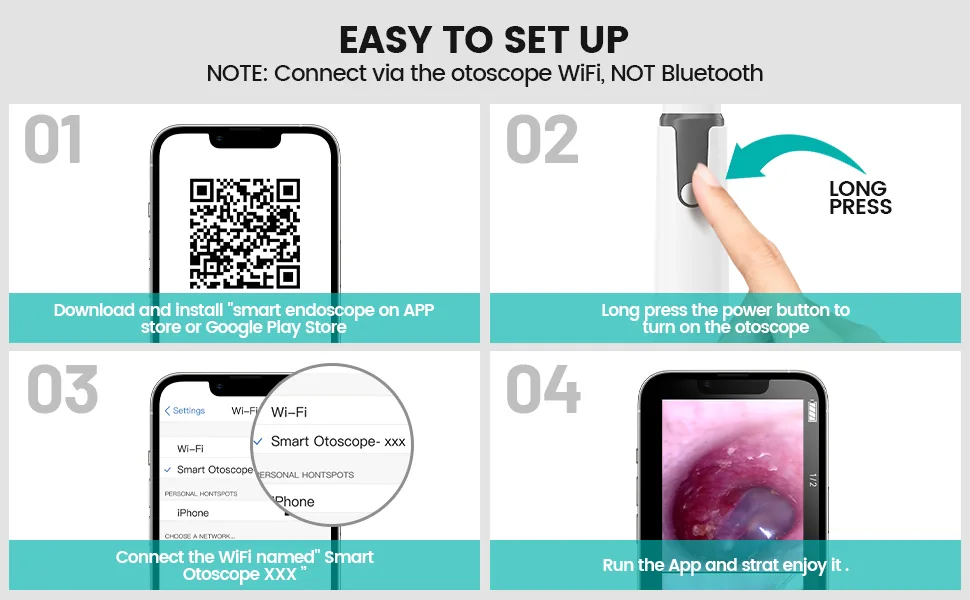 ScopeAround Wireless Otoscope Ear Camera Ear Wax Removal Kit Camera with 6 LED Lights 3.9mm Visual Ear Scope for Kids Adults & Pets Compatible with Android/iPhone/iPad (White) - wireless otoscope