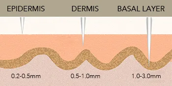 Dr.roller Derma Roller Hair Growth Men Beard Roller Microneedling Roller for Growth 540 0.5mm Titanium Micro Needles Beard Growth Roller Derma Roller 0.5mm for Stimulate Beard and Hair Growth - derma roller hair growth men