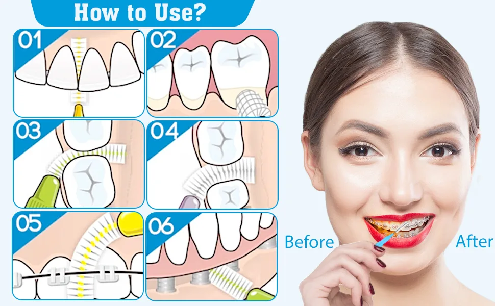 100 Pieces Interdental Brushes 6 Sizes Soft Dental Floss Brush Mini Floss Sticks Dental for Braces Oral Cleaning - product information 10