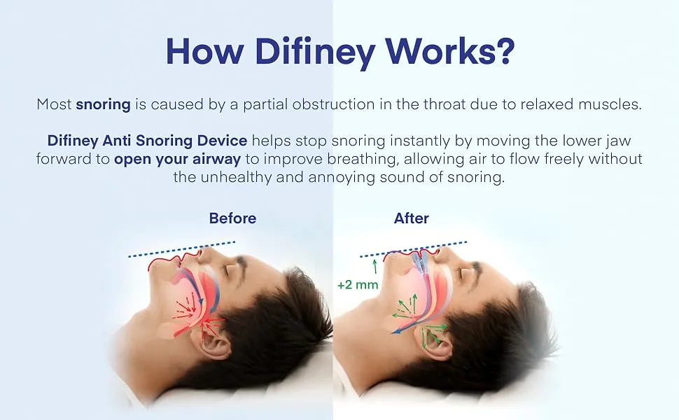Difiney Anti Snoring Devices Stop Snoring Devices Effective Snoring Solution Anti Snoring for Men and Women - product information 2