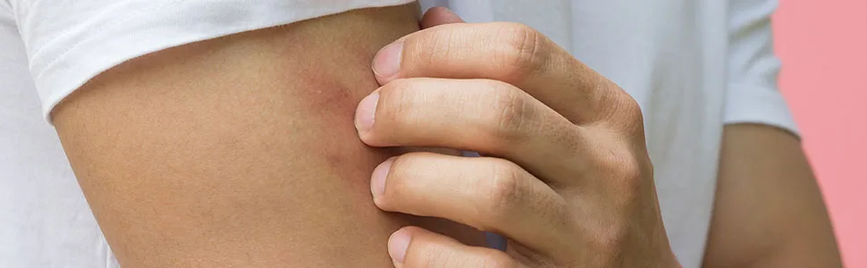 VIE After Bite Roll On 20ml - Anti Mosquito