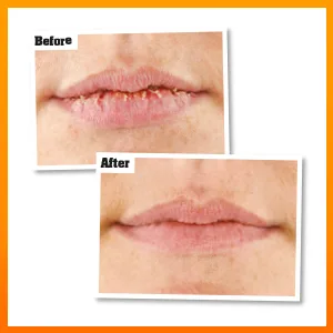 O'Keeffe's Lip Repair and Protect SPF15 4.2g 4.2 g (Pack of 1) SPF - Before & After