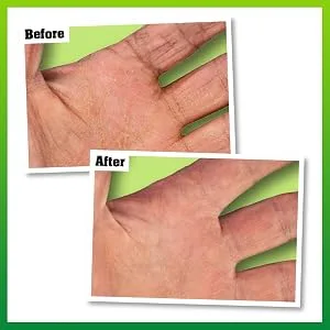 O'Keeffe's Working Hands Overnight 80ml - WH - Before & After