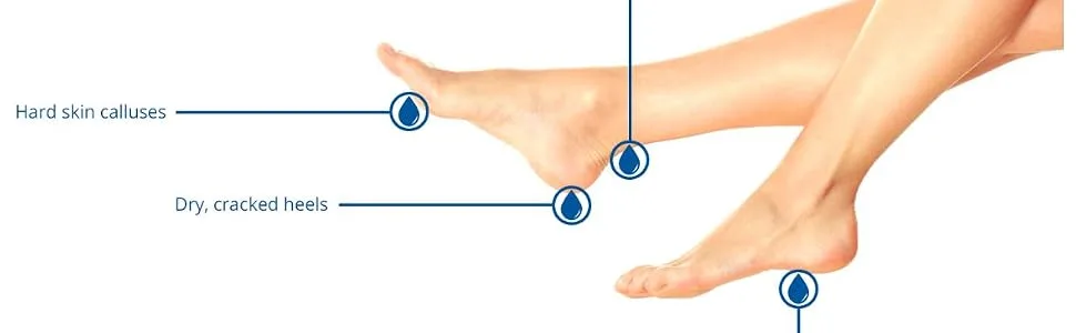 Flexitol Platinum Express Heel Balm 50g Intense Rapid Repair and Moisturisation for Cracked Heels and Dry Feet - Foot image
