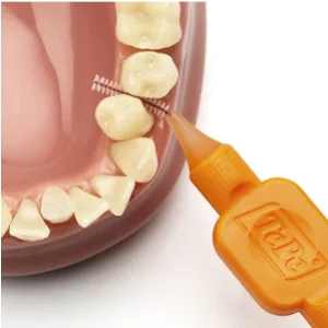 TePe Interdental Brush 0.45 mm Orange 8 pieces 8 count (Pack of 1) Orange (Size 1) - tepe interdental cleaning