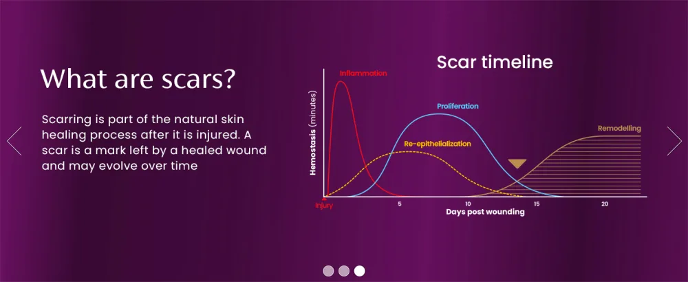Mederma Advanced Gel - Advanced Scar Care for Scars - 20 ml (Pack of 1) - what are scars?