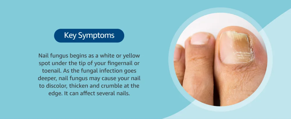 Amazon Basic Care Fungal Nail Treatment Pen 4ml 4 ml (Pack of 1) - product information 3
