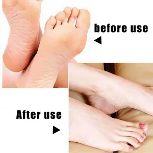 8 Pcs Replacement Rollers Extra Coarse Hard Skin Remover Refills Foot File Replacement Rollers Heads - product information 2