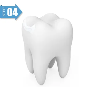 Temporary Tooth Repair Beads For Missing Tooth Filling Material With Broken Teeth Multifunction Temporary Tooth Repair Set Plastic (20g) - Missing Tooth Filling Material