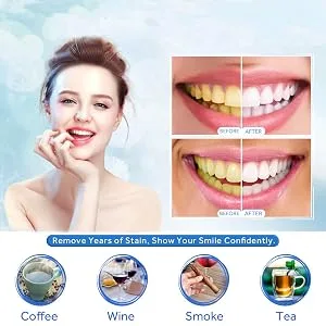 Gingival Protection Gel CARESHINE 10pcs 3ml Gum Protector Gel Gum Dam Barrier Gum Protection Gel Syringe Tip Teeth Whitening Decrease Sensitivity - Gingival Protection Gel