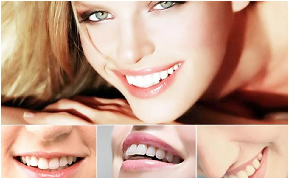 Gingival Protection Gel CARESHINE 10pcs 3ml Gum Protector Gel Gum Dam Barrier Gum Protection Gel Syringe Tip Teeth Whitening Decrease Sensitivity - Gingival Protection Gel