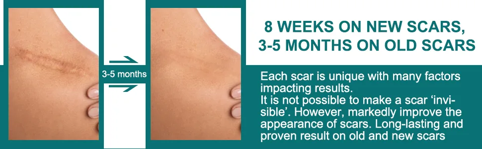 Silicone Scar Sheets Professional for Scars Caused by C-Section Surgery Burn Keloid Acne and More Drug-Free Silicone Scar Roll 3Meters  - product information 4