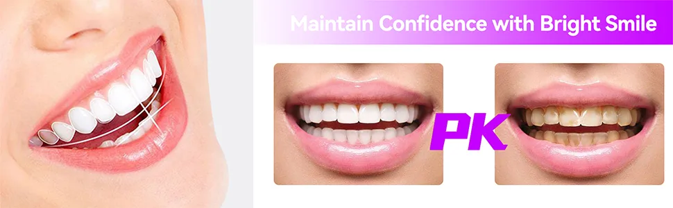 Dental Polishing Strips 50um Thickness Tooth File Teeth Abrasive Finishing Strips Oral Care Deep Teeth Cleaning Tool - product information 2