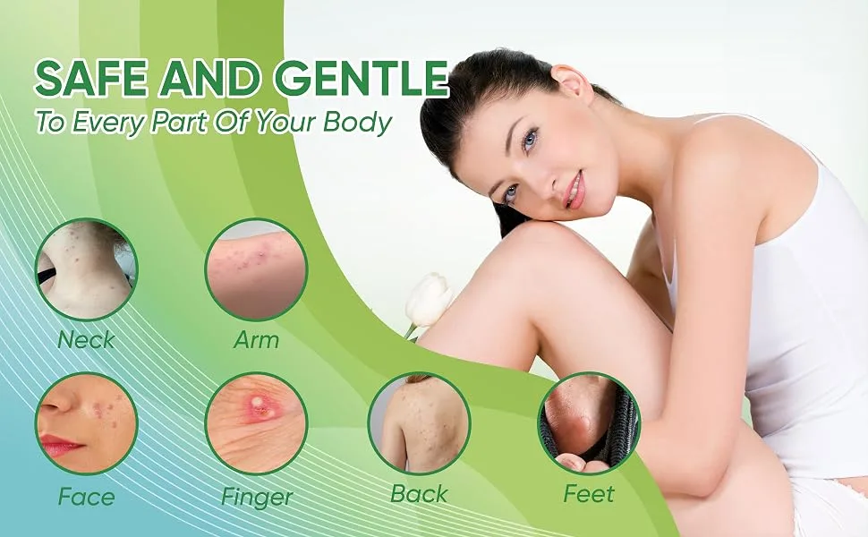 Pimple Patch Device Effective Patch for All Skin Types Herbal Condensed Patch for Small Large Pimples Wart - 72 Patches Wart & Blackhead - 72 Patches - product information 4