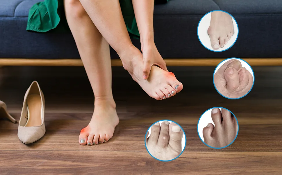 Toe Spacers(2 Pair) Gel Toe Separators to Correct Toes Bunion Corrector for Women Men Toe Spacer Hammer Toe Straightener Toe Stretcher Big Toe Separators (Blue) - toe sparators