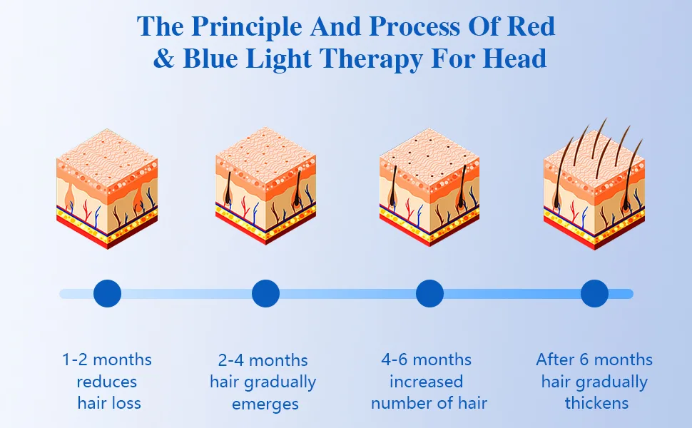 KTS Hair Regrowth (Hat) - hair growth products