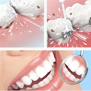 YanBan 2pcs Replacement Orthodontic Nozzle Orthodontic Brush for WP450 WP-100 WP100E WP-250 WP-300 WP-660 WP-900 - product information 3