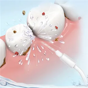 YanBan 2pcs Replacement Orthodontic Nozzle Orthodontic Brush for WP450 WP-100 WP100E WP-250 WP-300 WP-660 WP-900 - product information 7