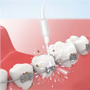 YanBan 2pcs Replacement Orthodontic Nozzle Orthodontic Brush for WP450 WP-100 WP100E WP-250 WP-300 WP-660 WP-900 - product information 8