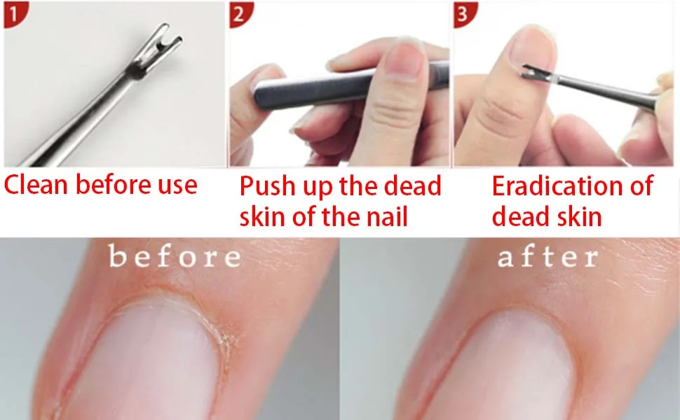 Cuticle Remover Cuticle Pusher Nails Cleaner Stainless Steel Anti-slip Dead Skin Cutter - Cuticle Remover
