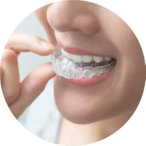 Beary Quiet Mouth Guard for Grinding Teeth Anti Snore Prevent Bruxism Sport Gum Shield Reusable 2 Sizes 4 Pcs - Shape