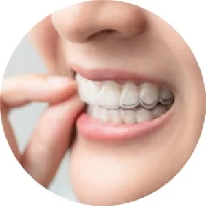 Beary Quiet Mouth Guard for Grinding Teeth Anti Snore Prevent Bruxism Sport Gum Shield Reusable 2 Sizes 4 Pcs - Sleep