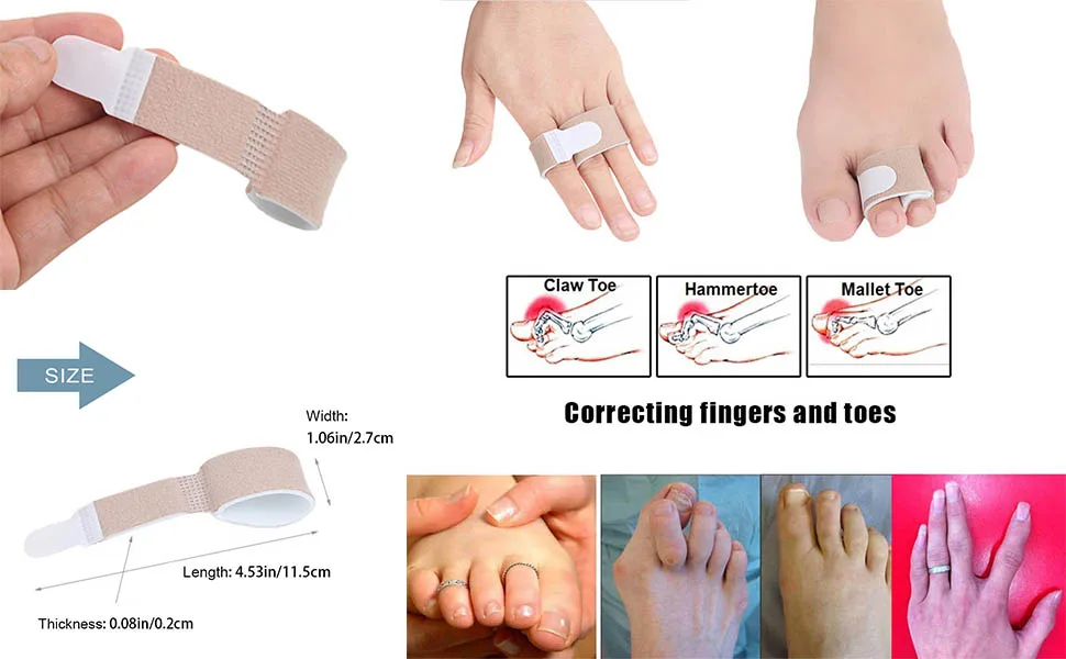 HouChanges Toe Straighteners Reusable for Toe Toe Splints for Bent Toes Hammer Toes Overlapping Toes Broken Toes One Size - product information 2