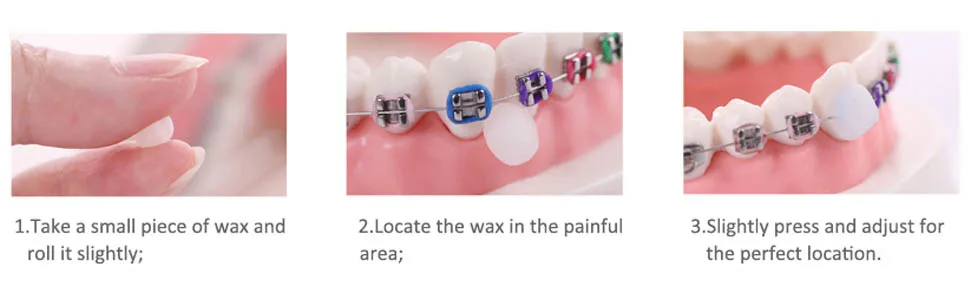 Dental Wax for Braces Orthodontic Wax for Braces(Mint 3Box for 150Times) - product information 2