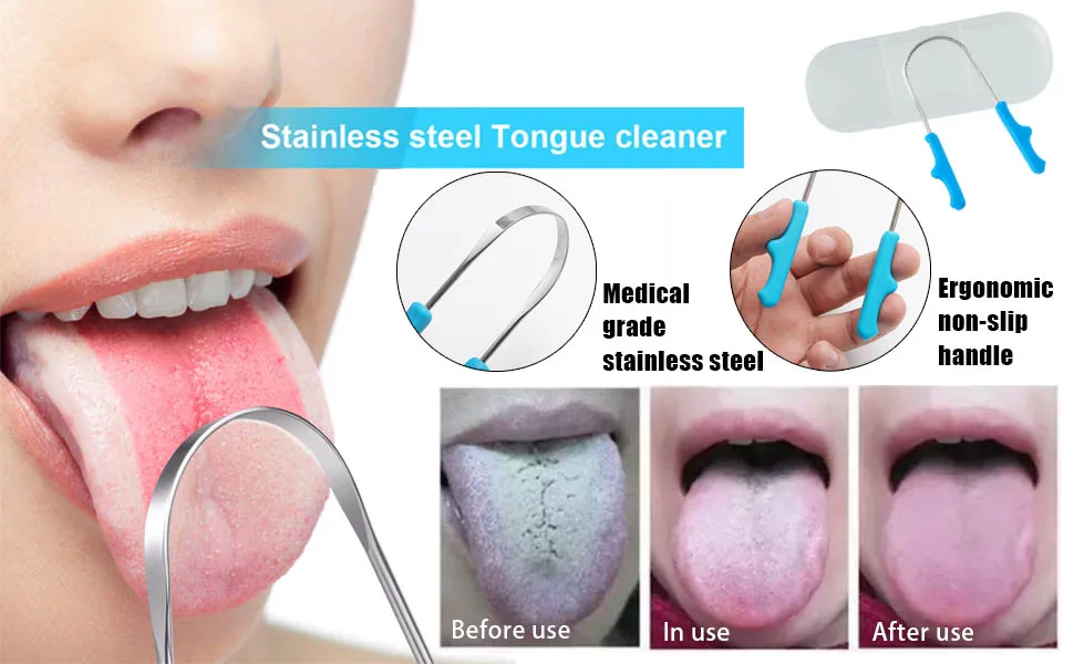 Tongue Scraper Stainless Steel Tongue Cleaner with Storage Box Fights Bad Breath for Oral Care - product information 2