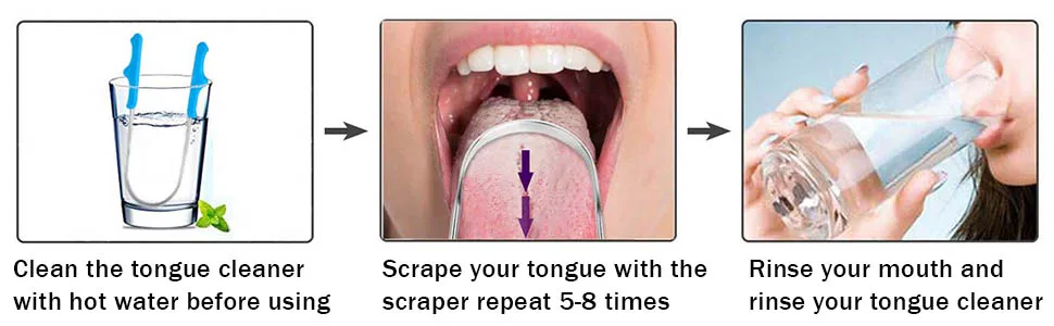 Tongue Scraper Stainless Steel Tongue Cleaner with Storage Box Fights Bad Breath for Oral Care - product information 3