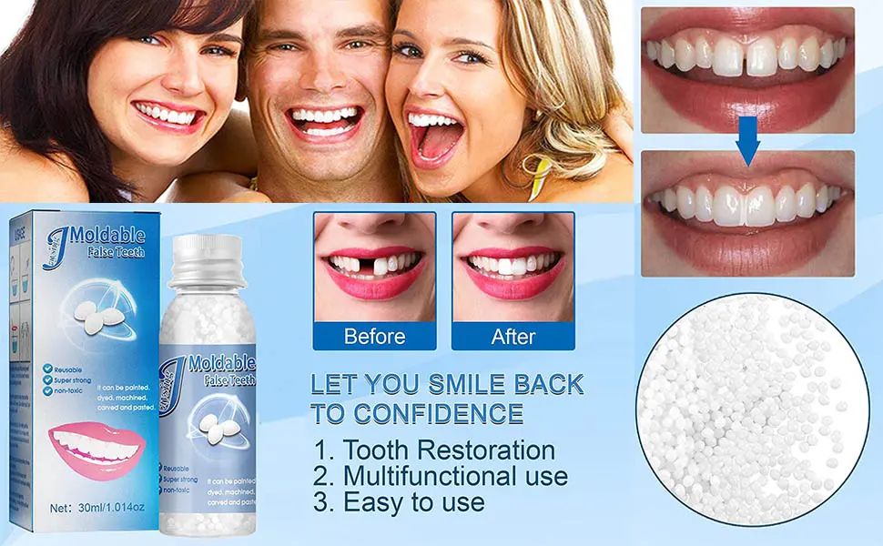Temporary Tooth Repair Kits Dental Repair Denture Repair Beads for Temporary Fixing Filling Missing Broken Tooth Moldable Fake Teeth - product information 2