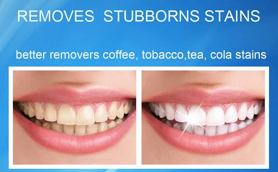 Dental Tartar Remover for Teeth Teeth Polishing Tooth Stain Clean Teeth Whitening(White) - product information 3