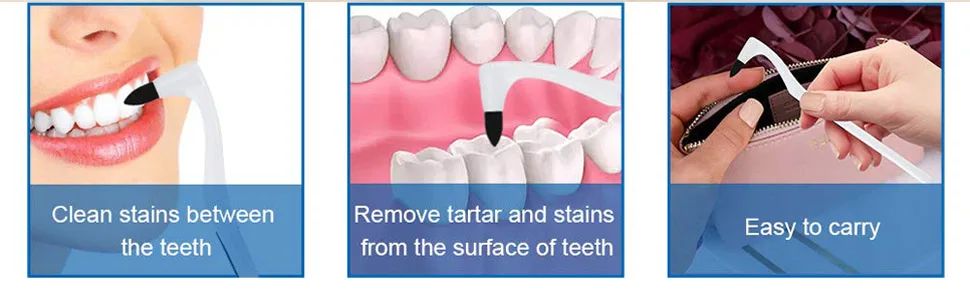Dental Tartar Remover for Teeth Teeth Polishing Tooth Stain Clean Teeth Whitening(White) - product information 5