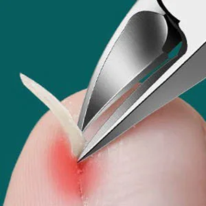 Toe Nail Clipper Heavy Duty Professional for Thick Nails Ingrown Nails Dead Skin Calluses - product information 4