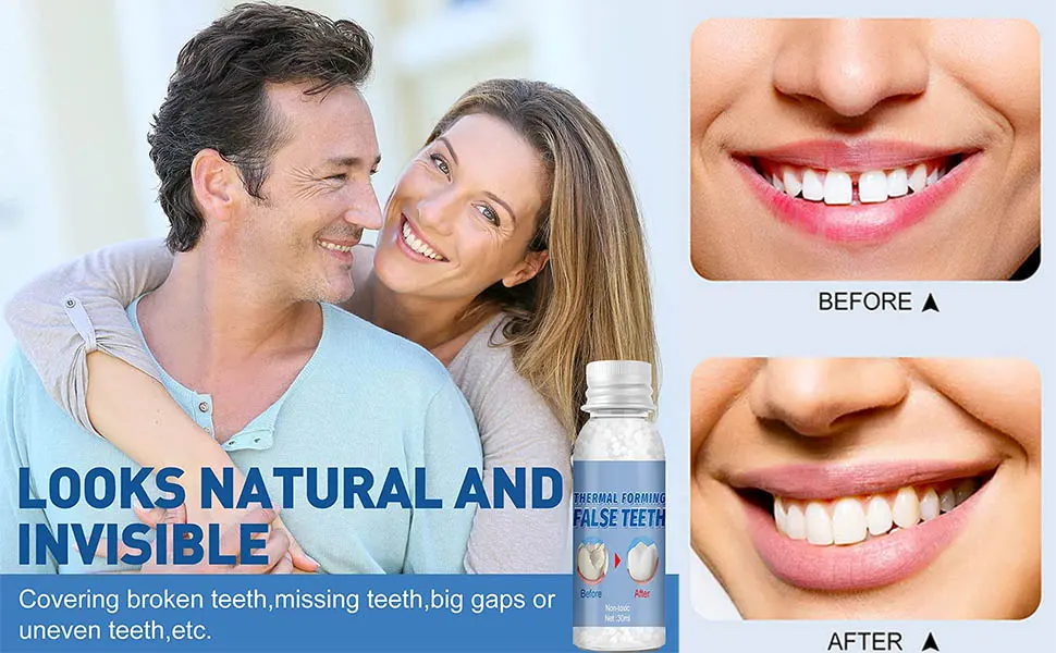 Temporary Tooth Filling Tooth Repair Moldable Fake Teeth Repair Beads for Temporary Fixing Filling Missing Broken Tooth Dental - product information 2