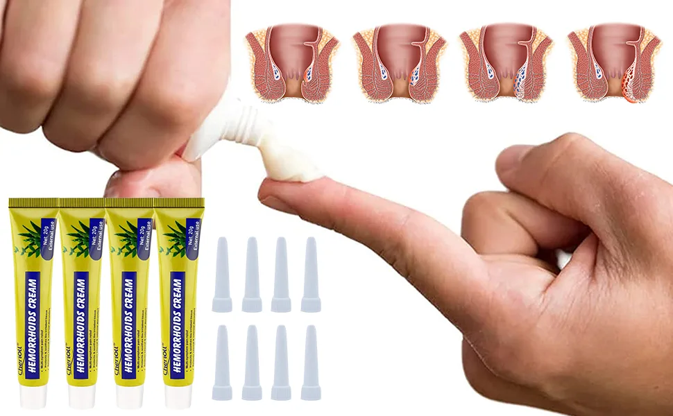Hemorrhoid Cream Hemorrhoids Ointment 4 PCS Natural Herbal Hemorrhoid Cream Natural Cream Relieving Itching 4pcs - product information 3