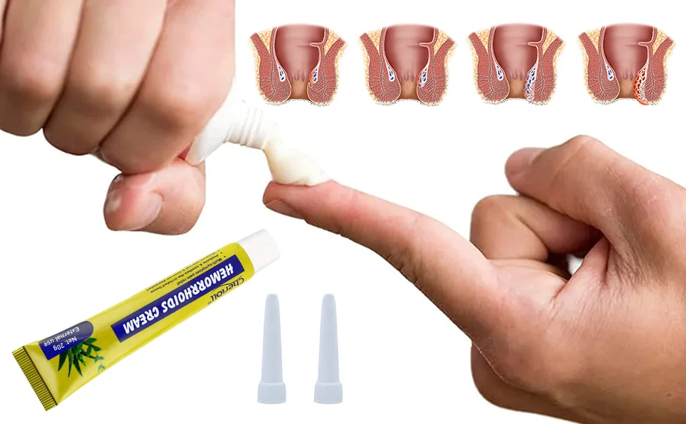 Hemorrhoid Cream Hemorrhoids Ointment Natural Herbal Hemorrhoid Cream Natural Cream Relieving Itching 1PCS - product information 3