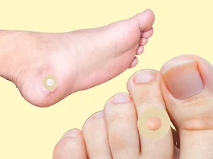 Rysons Corn Pads Soft Protector Rings 24 Pads - toes and foot