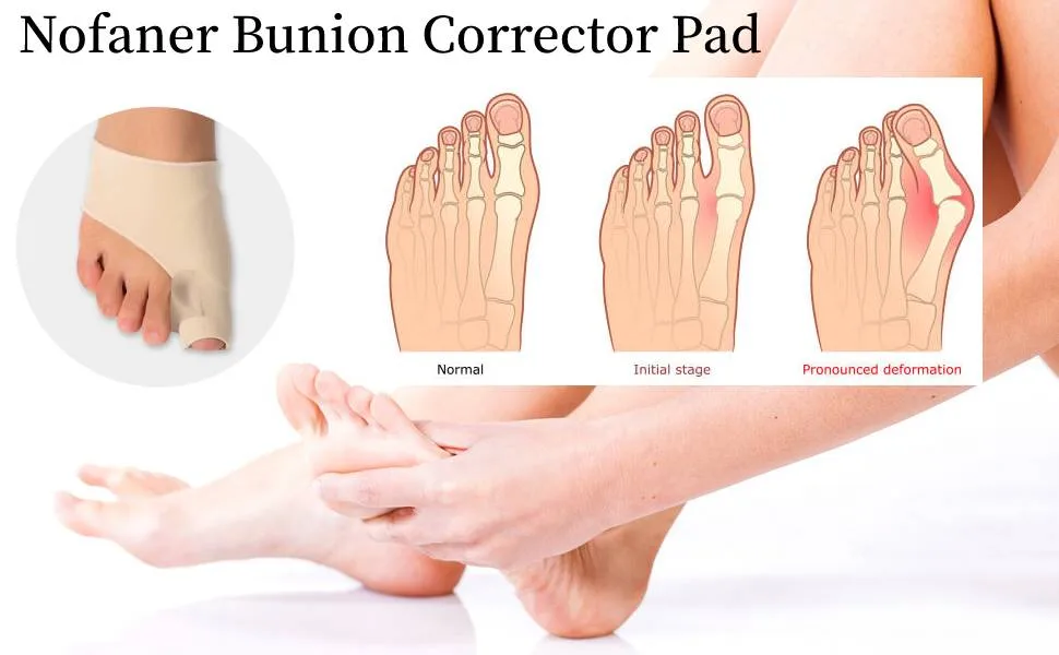 Bunion Corrector Big Toe Straightener with Gel Pads Toe Splints Bunion Splint Support Protectors Sleeve for Hammer Overlapping Toes Hallux Valgus - bunion pad