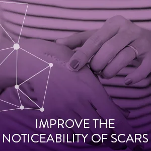 MRM MSM Cream 4 oz (113 g) - improve the noticeability of scars