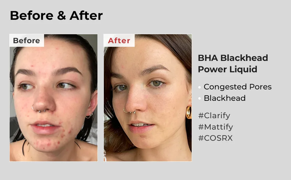 Cosrx BHA Blackhead Power Liquid 100 ml - cosrx bha blackhead removing toner facial essence moisturiser Korean skincare smooth skin exfoliate